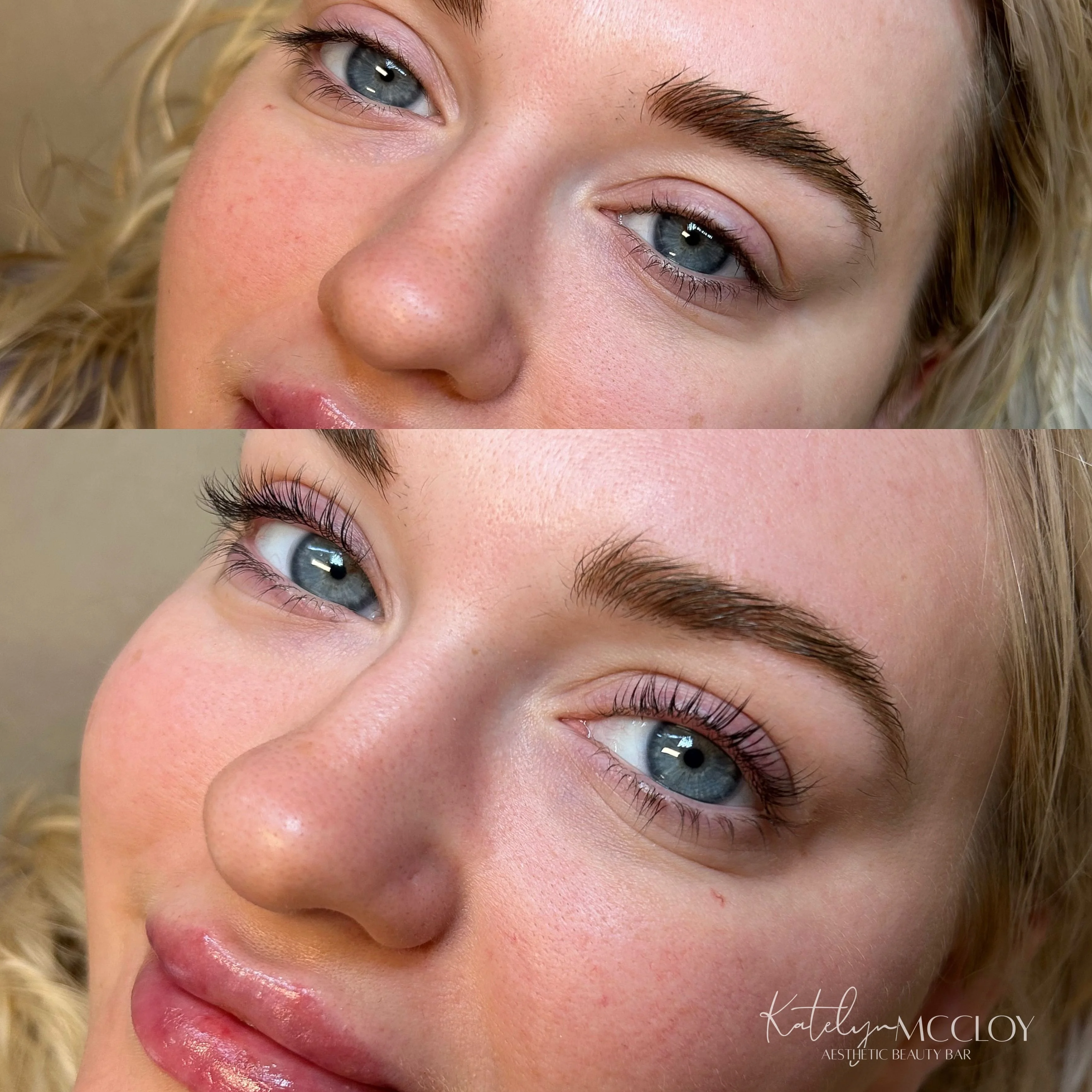 Service Menu Gallery Img ~ 1