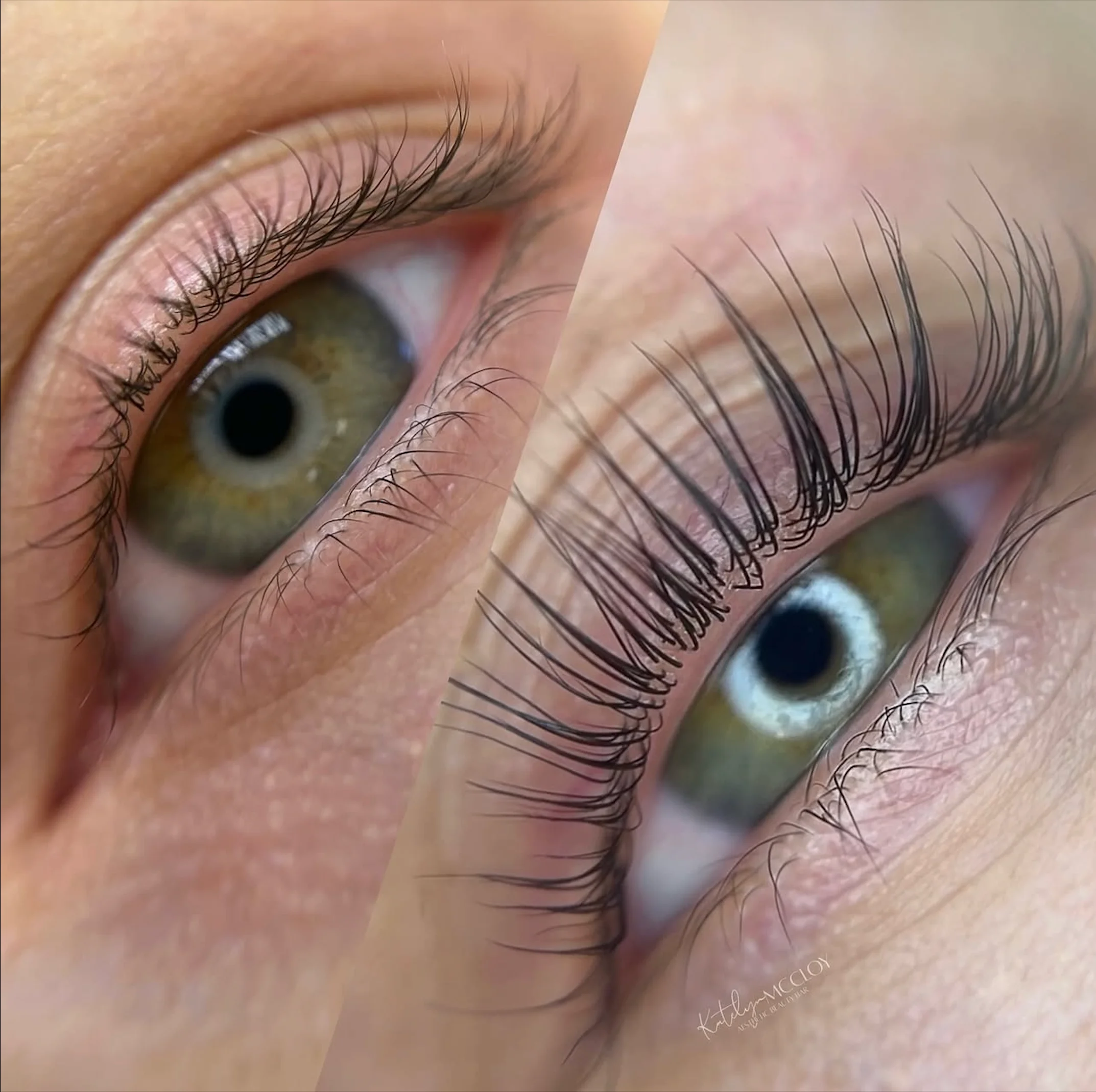 Service Menu Gallery Img ~ 13