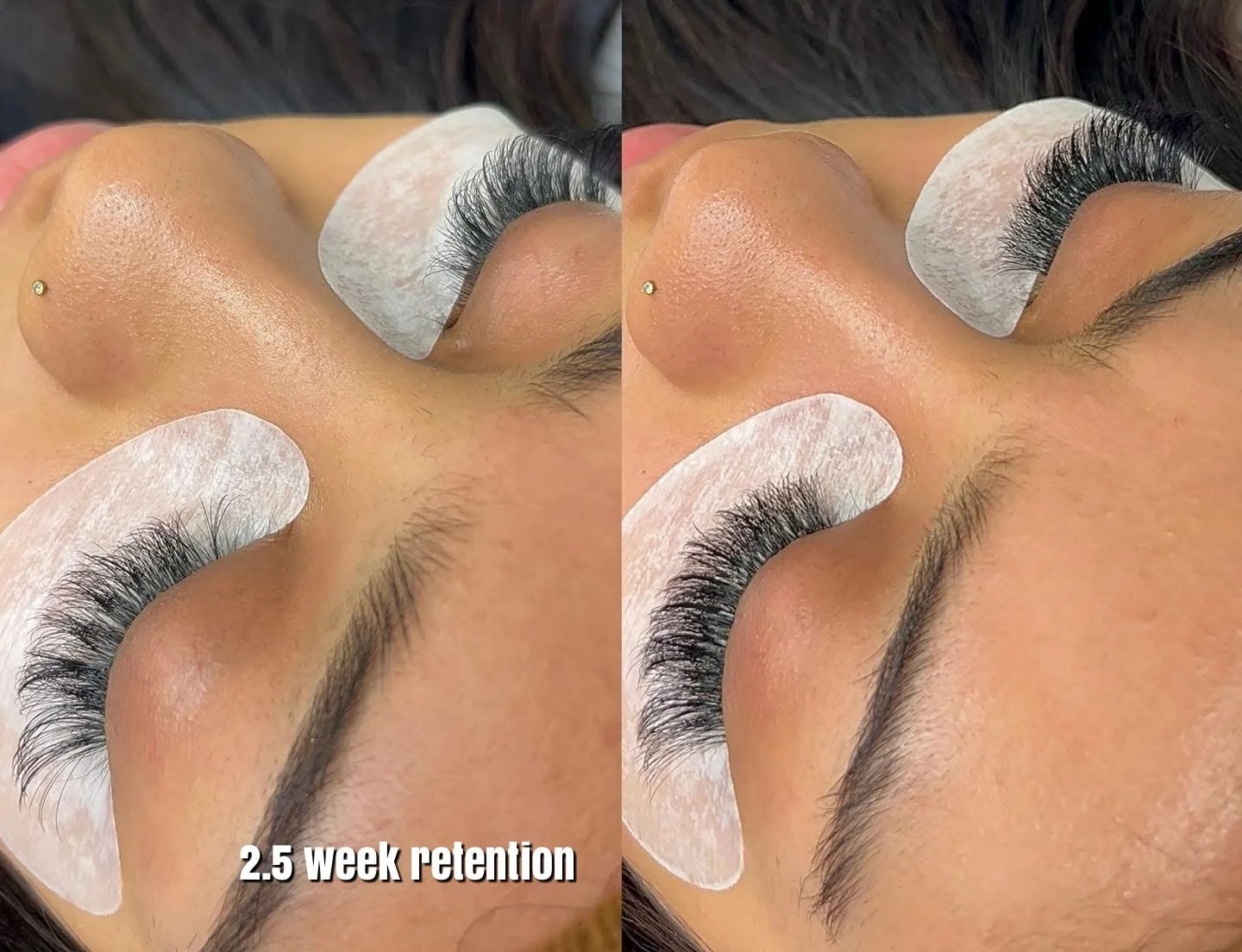 Service Menu Gallery Img ~ 14