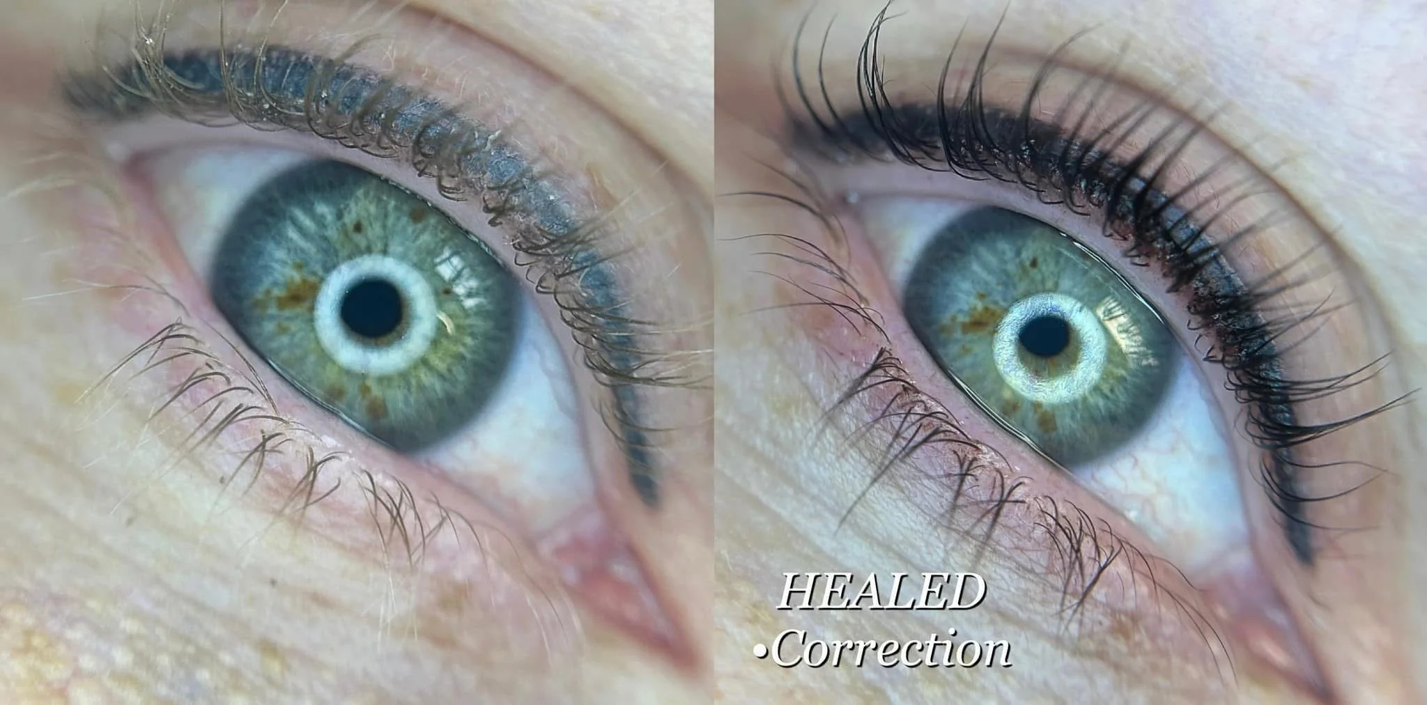 Service Menu Gallery Img ~ 16