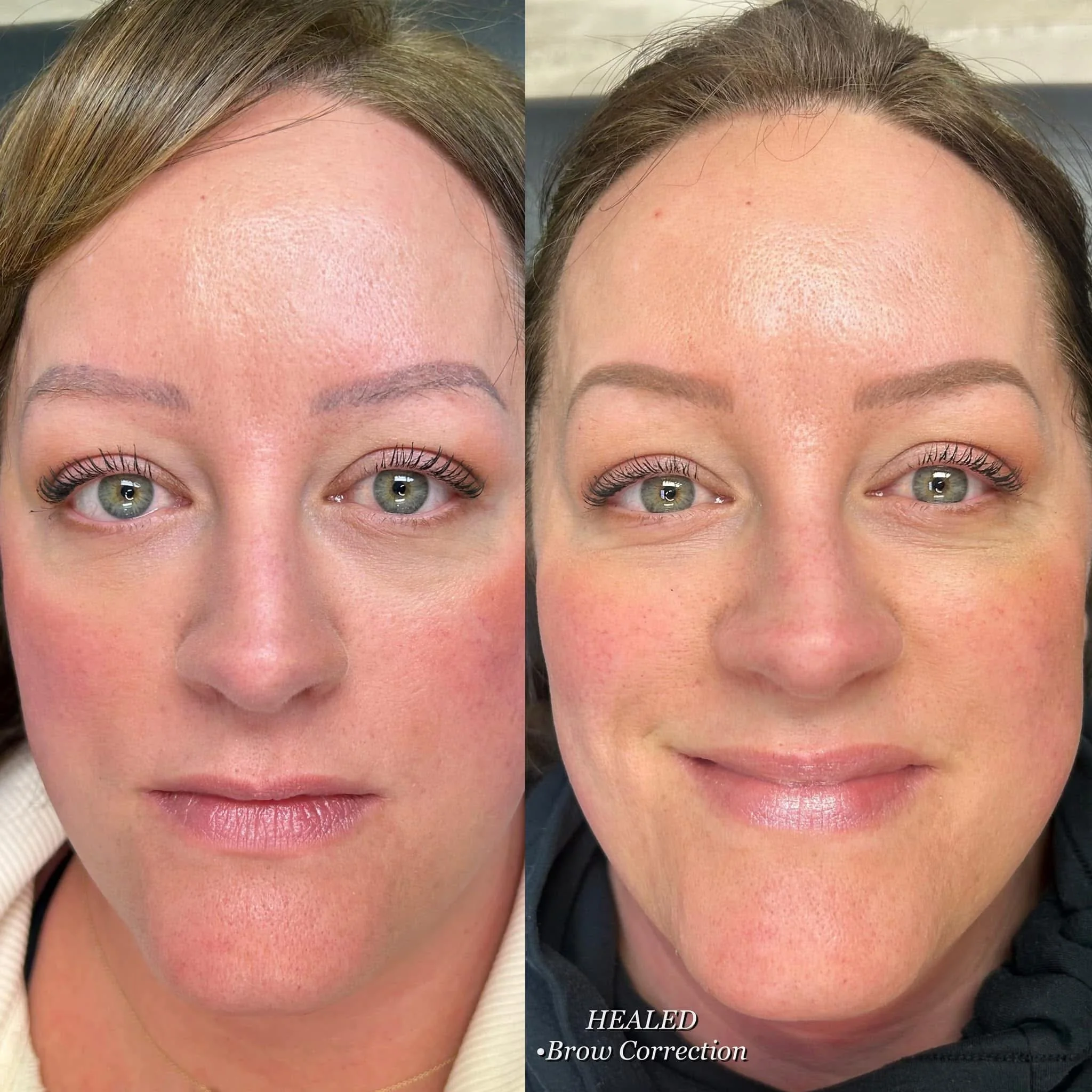 Service Menu Gallery Img ~ 8