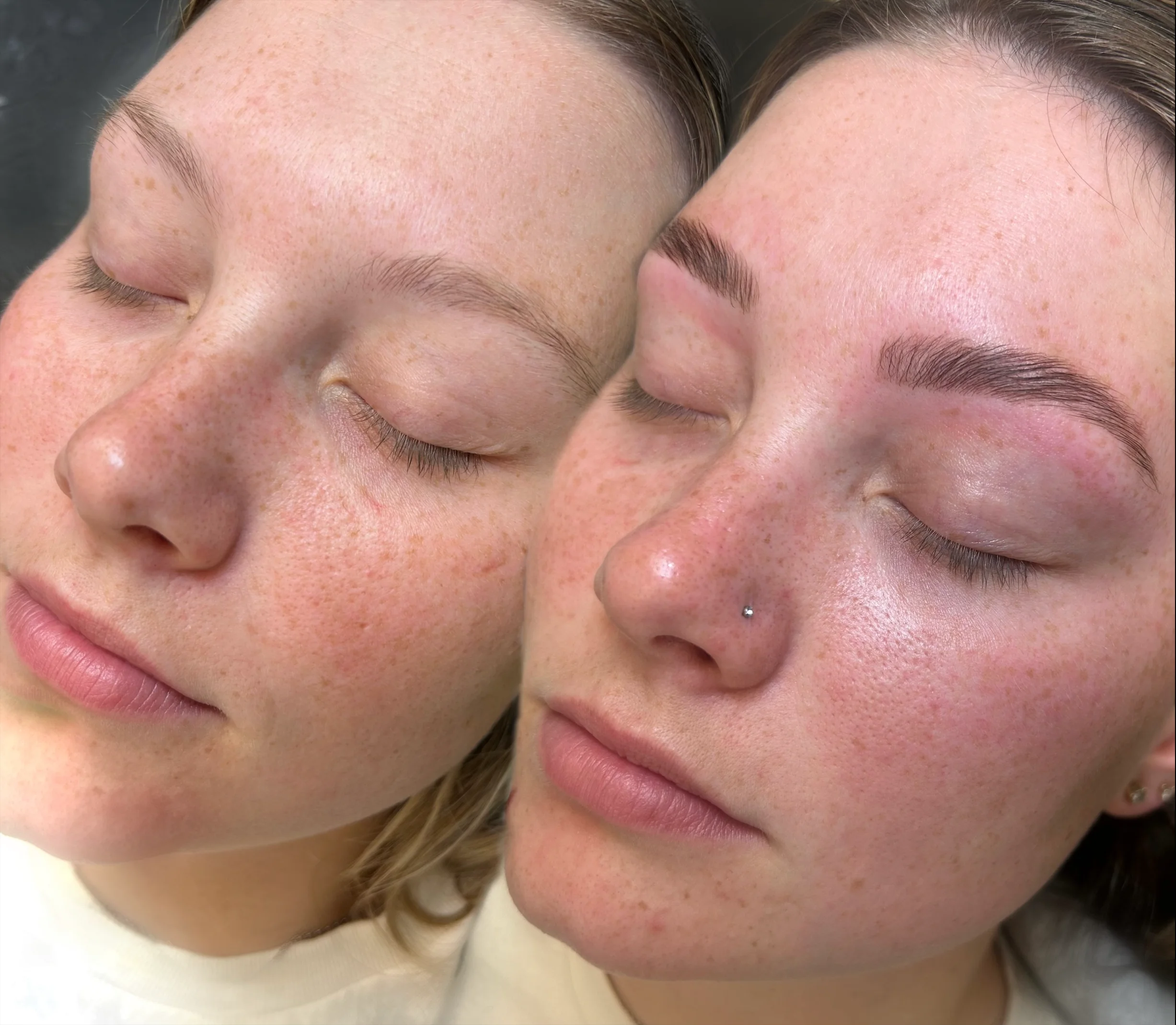 Service Menu Gallery Img ~ 9